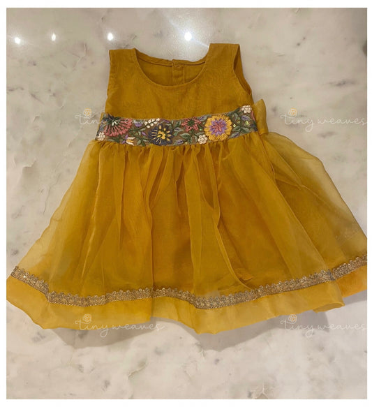 The lace dress [ yellow]